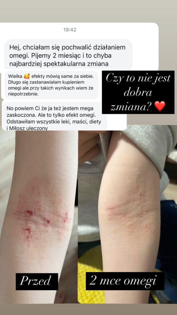 eqology omega-3 calareszta Dagmara Hicks opinie